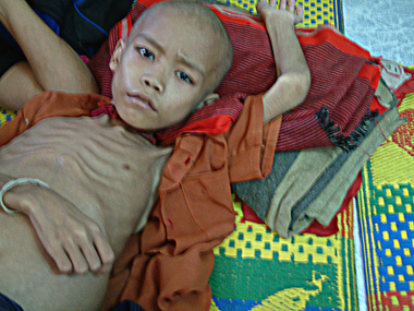 malnutrition2.jpg